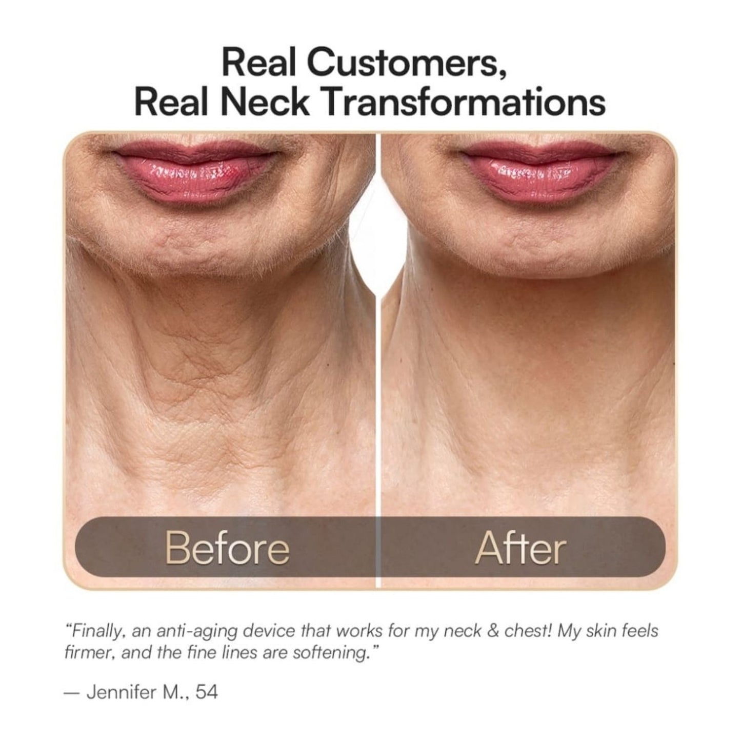 DERMALUX Advanced Anti-Aging Technology