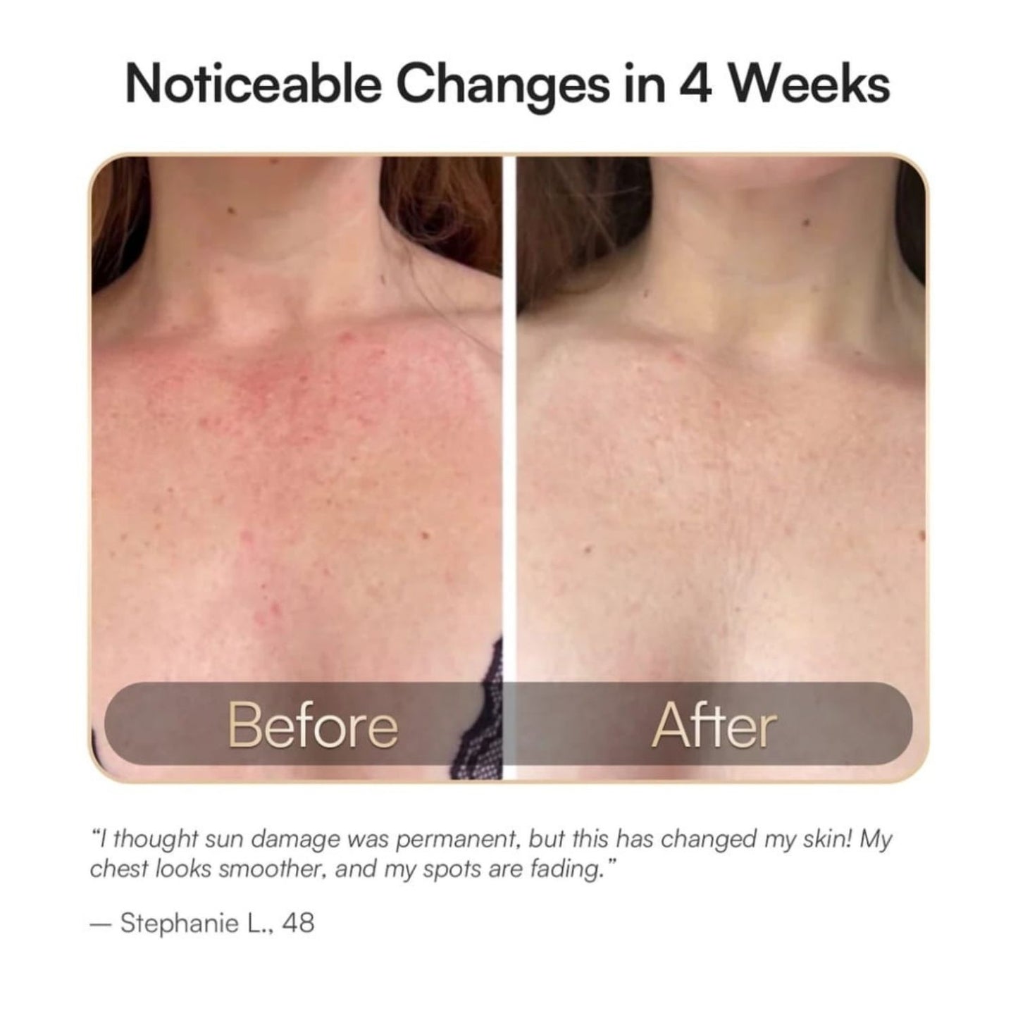 DERMALUX Advanced Anti-Aging Technology