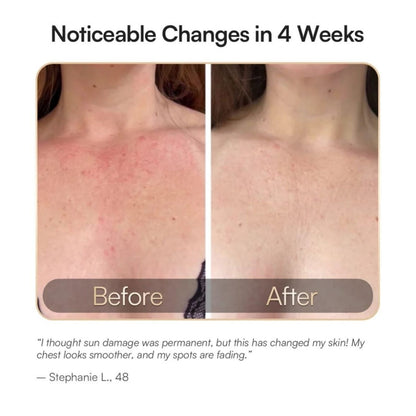 DERMALUX Advanced Anti-Aging Technology