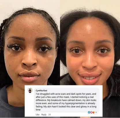 DERMALUX soin du visage au collagène