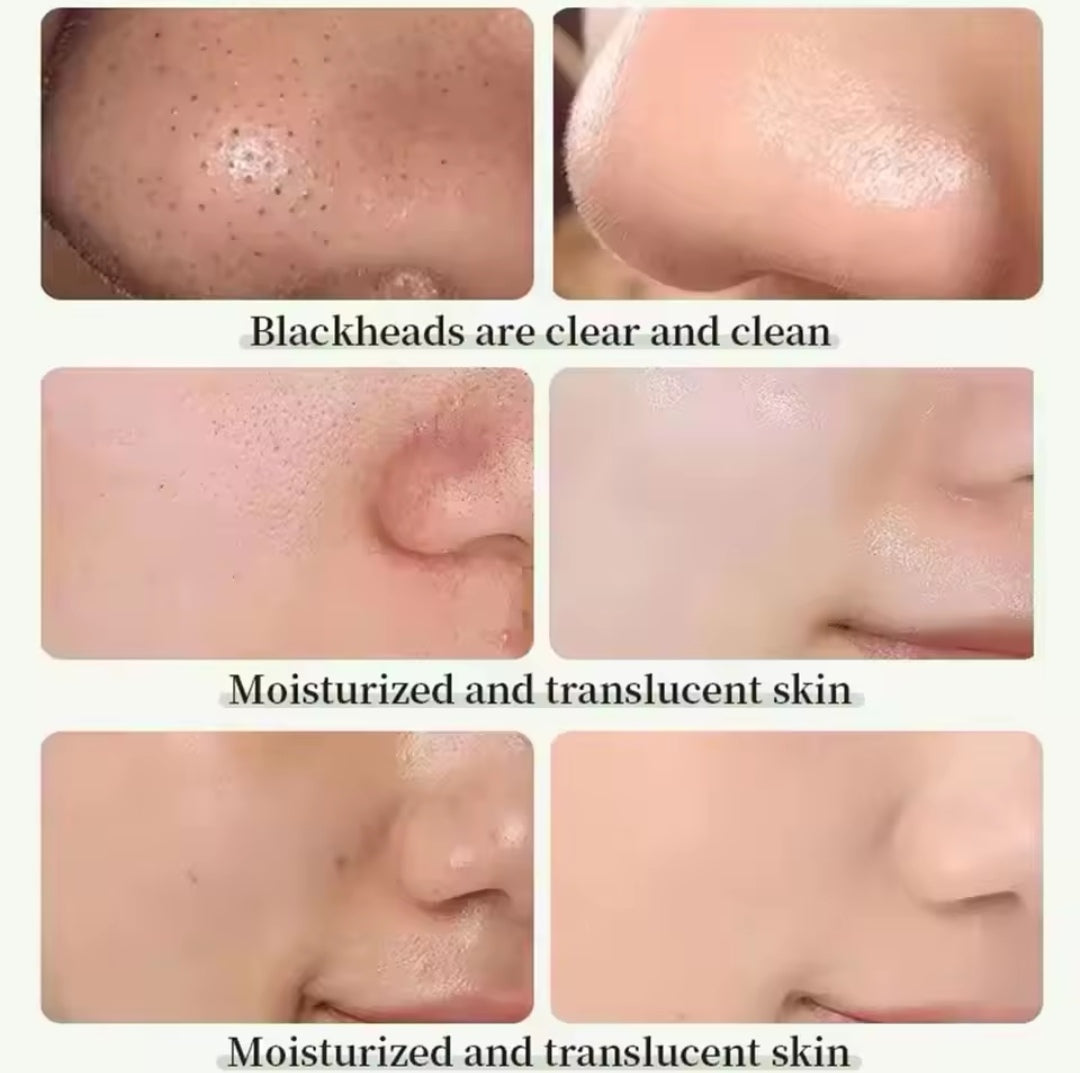 DERMALUX Green Heyxi